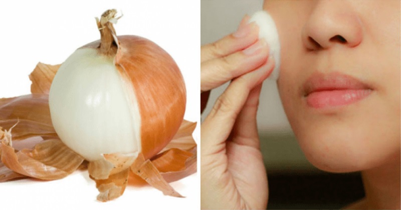 onion peels uses for beauty